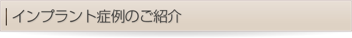 インプラント症例のご紹介