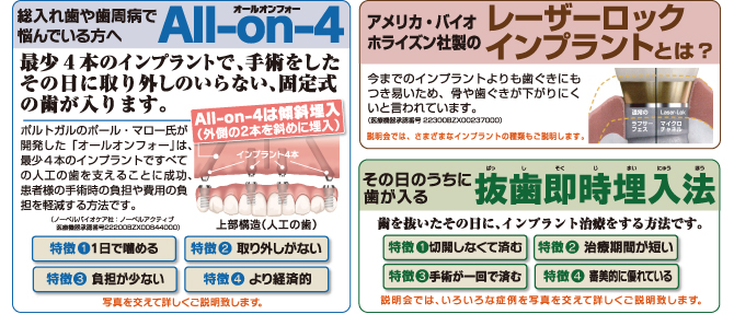 総入れ歯や歯周病で悩んでいる方へAll-on-4、アメリカ・バイオホラインズン社製のレーザーロックインプラントとは?、その日のうちに歯が入る抜歯即時埋入法